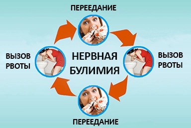 Лечение булимии в Новой Игирме
